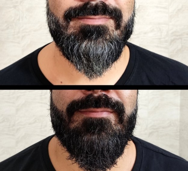 Barba antes e depois