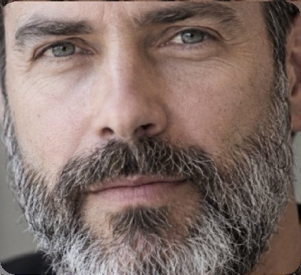 Barba com mais de 50% de brancos